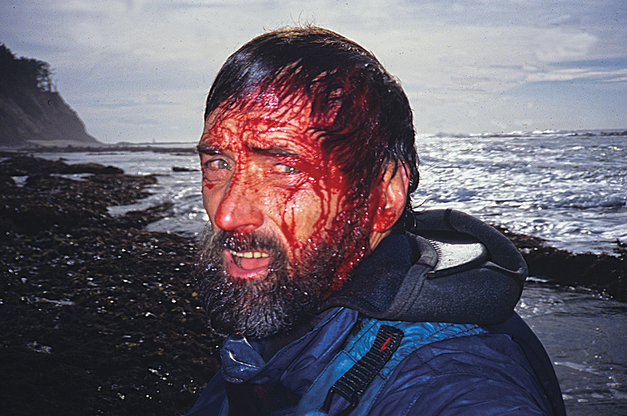 Bloody head